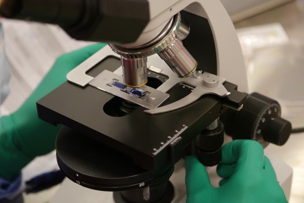 Autologous micrografts prepared and checked at London Cartilage Clinic