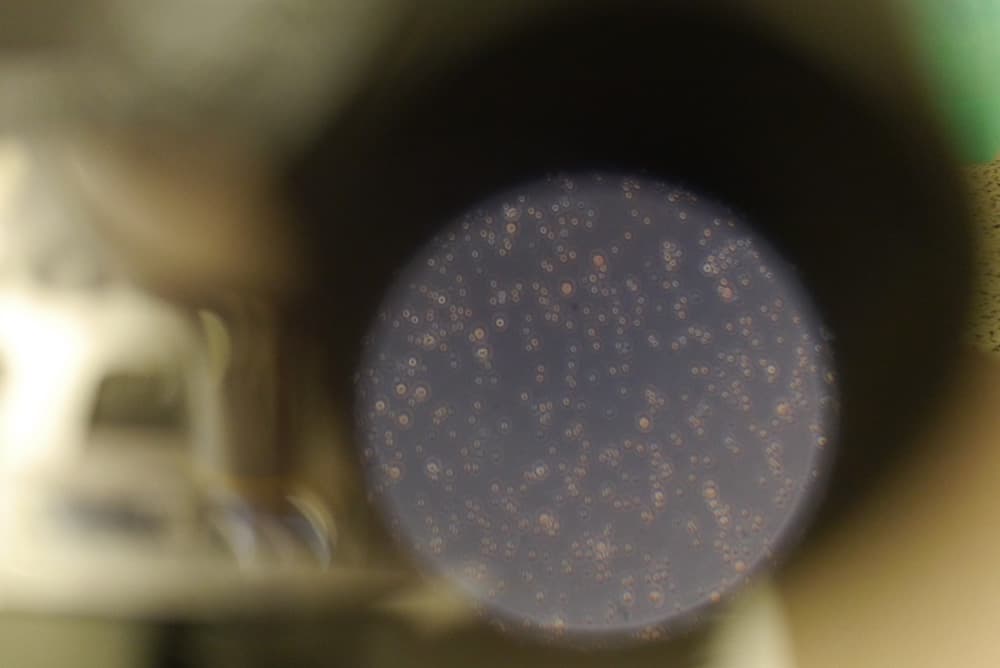 Regenerative micrografts prepared at London Cartilage Clinic